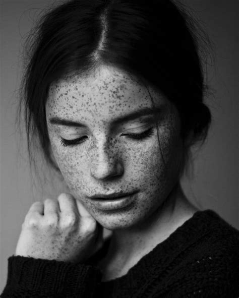 98 Freckled People Who’ll Hypnotize You With Their Unique Beauty